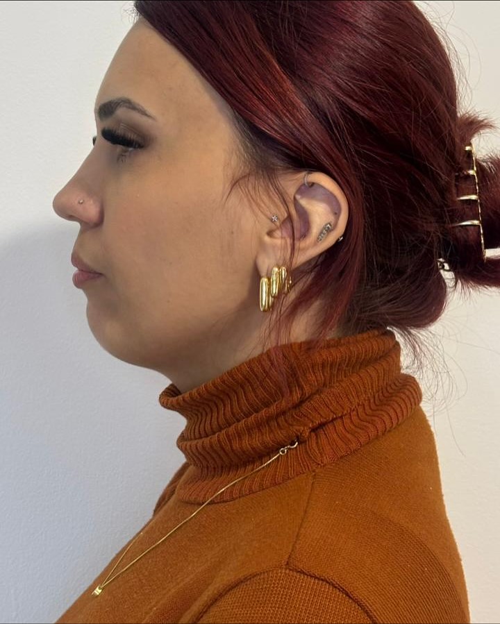 Harmonização de Perfil